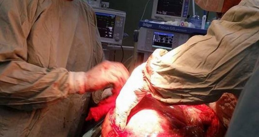 وفود طبية تغادر قطاع غزة بعد اجرائها لعمليات معقدة